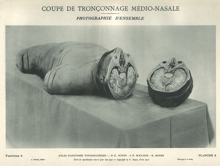 In the memory of Roberto P. / Mrs and M&nbsp;Hyde