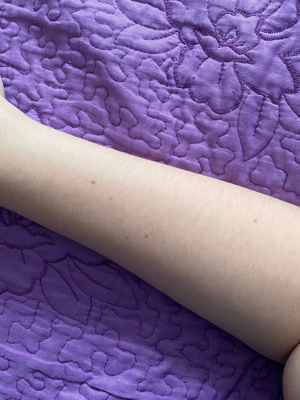 Nevus / A.R.&nbsp;Tivadar